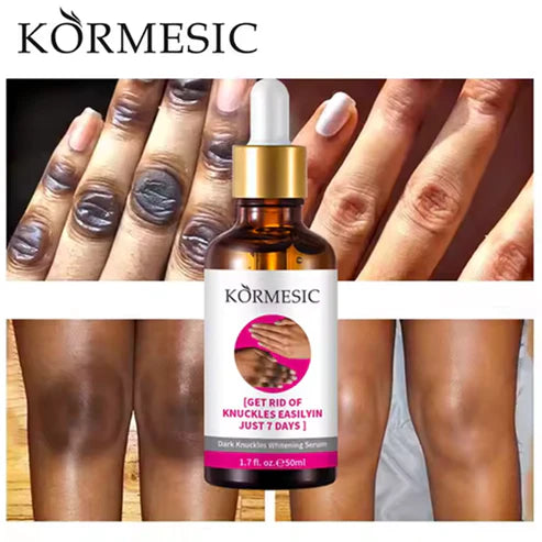 Knuckle Whitening Serum G