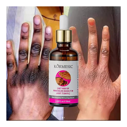 Knuckle Whitening Serum G